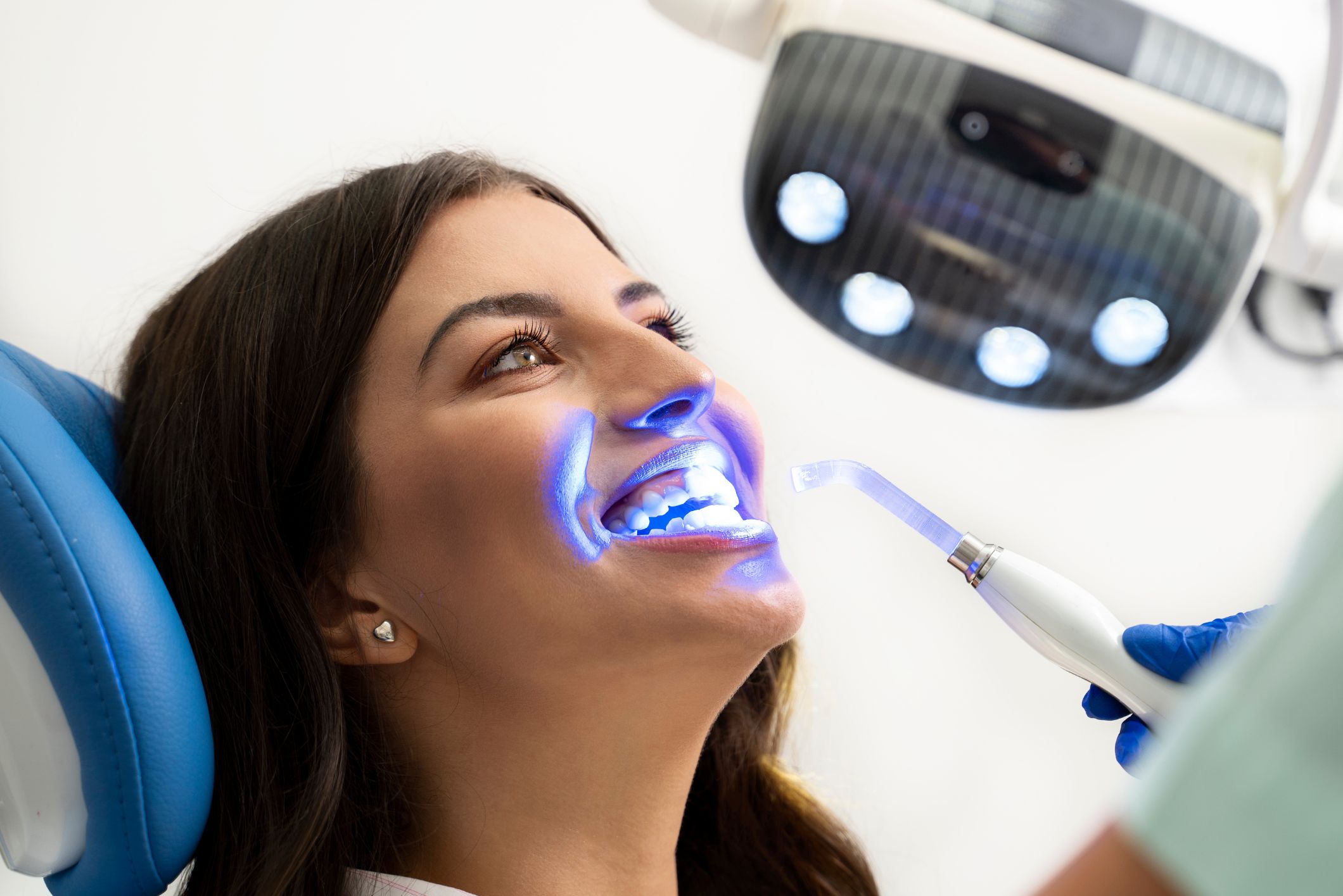 Teeth Whitening Professional teeth whitening treatment in Kingston dental hygiene clinic
